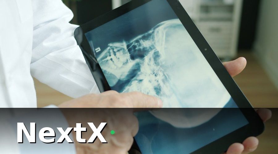 NextX — Giải Pháp: Triển Khai NextX Để Số Hóa Toàn Bộ Quy Trình