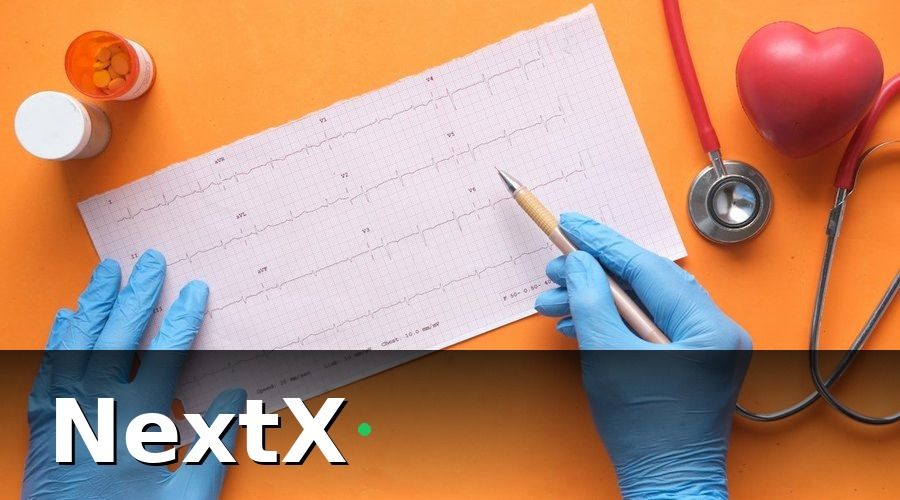 NextX — Các Chỉ Số Churn Quan Trọng Cần Theo Dõi